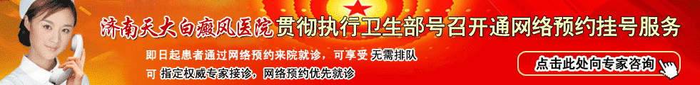 济南天大白癜风医院